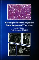 Küçük Resim